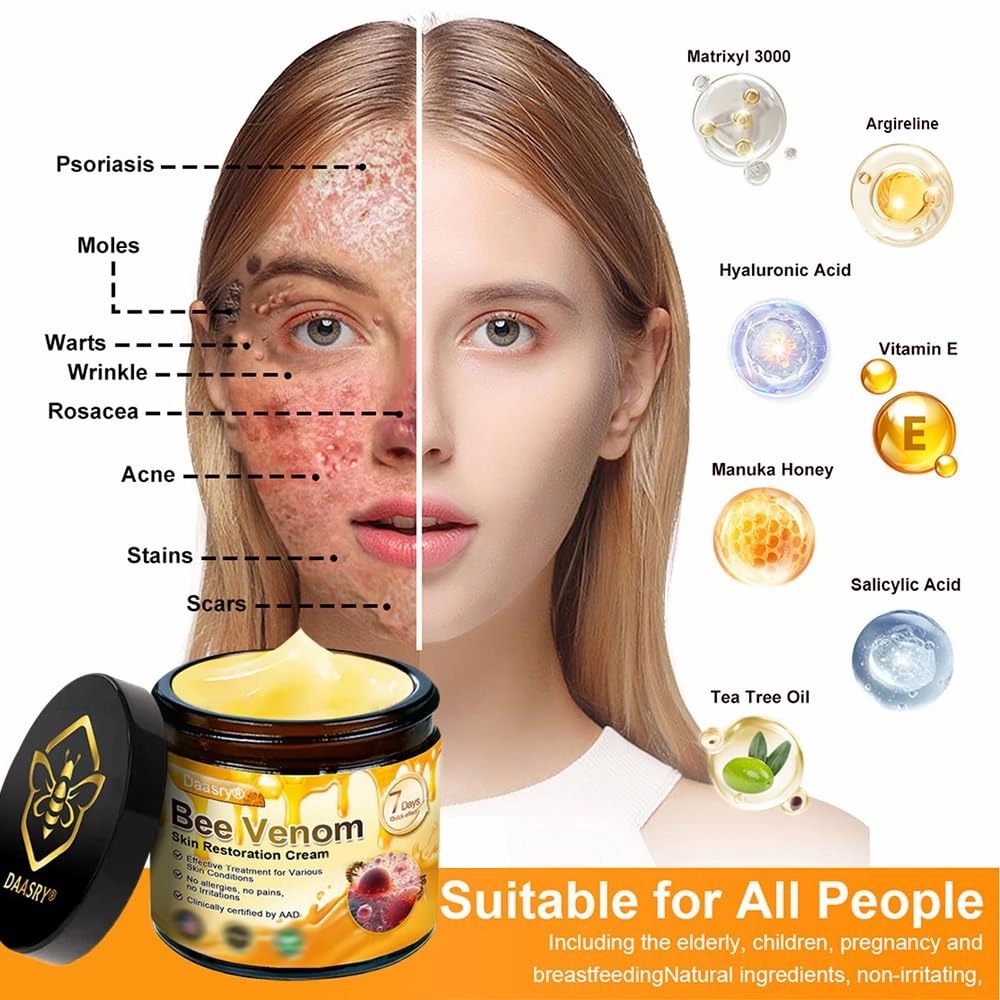 Bee Venom Skin Restoration Cream, Bee Venom Skin Treatment Cream, Botox Bee Venom Wrinkle Removal cream for All skin Types (4)