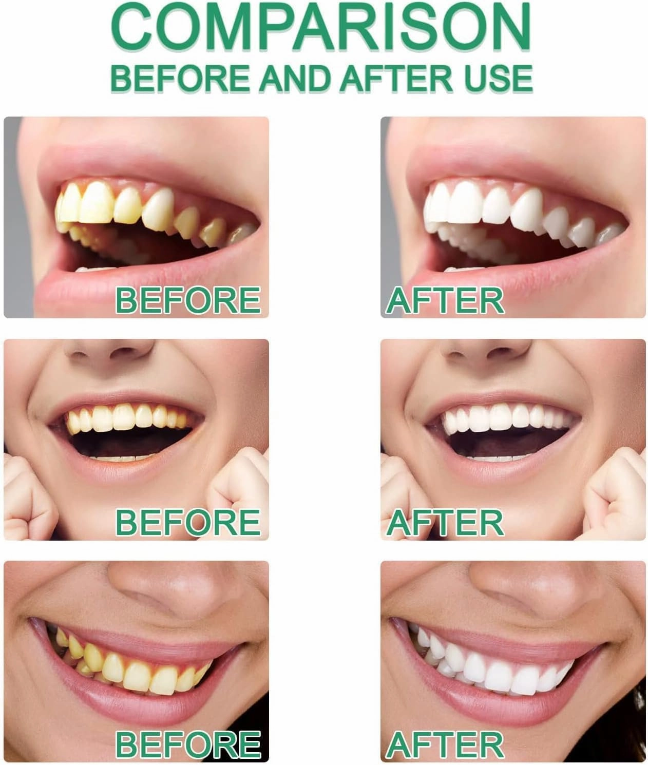 Elovelle Toothpaste, Elovelle Niacinamide Whitening Toothpaste, Advanced Whitening 𝐓𝐨𝐨𝐭𝐡𝐩𝐚𝐬𝐭𝐞, Enamel Care Formula, Strengthens and Protects Teeth (2)