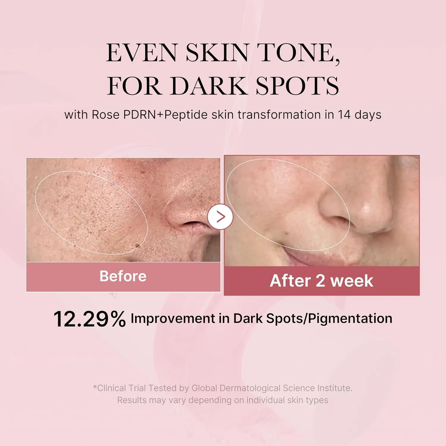 medicube PDRN Pink Peptide Toner I Pink Glow Toner for Skin Boosting, Soothing and Calming, Uneven Skin Tone, Rose PDRN & Peptide & Niacinamide, Korean Skin Care (250ml / 8.45 fl. oz.)