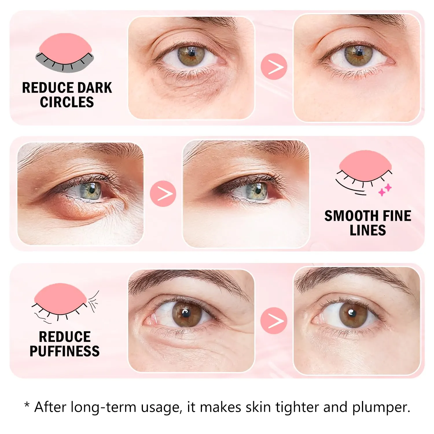 Under Eye Patches (30 Pairs) 24K Gold Eye Mask and Hyaluronic Acid Eye Patches for Puffy Eyes, Rose Eye Masks for Dark Circles, Puffiness, Eye Bag, Wrinkles - Gift for Women